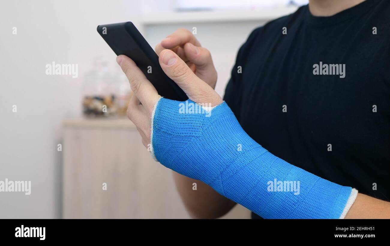 Fiberglass Cast High Resolution Stock Photography and Images Alamy