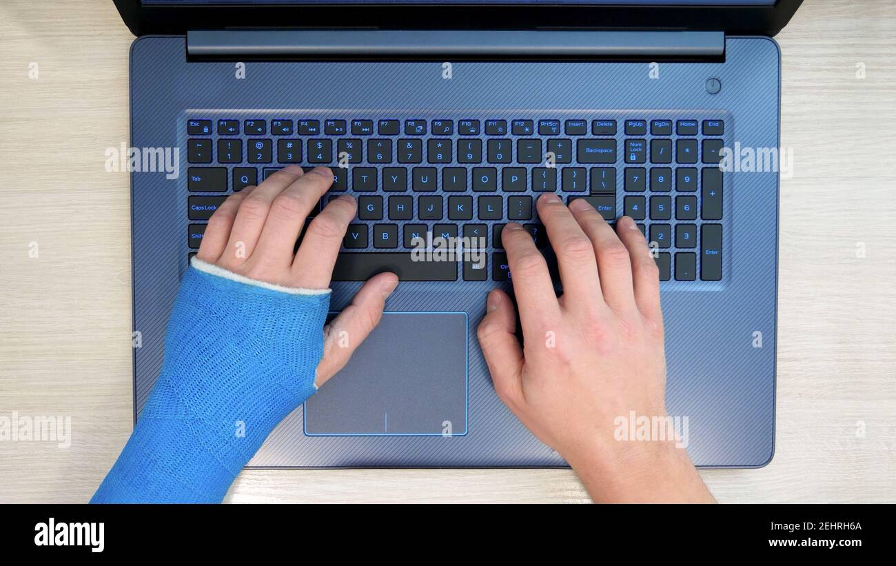 Fiberglass cast hand typing laptop surfs internet Stock Photo