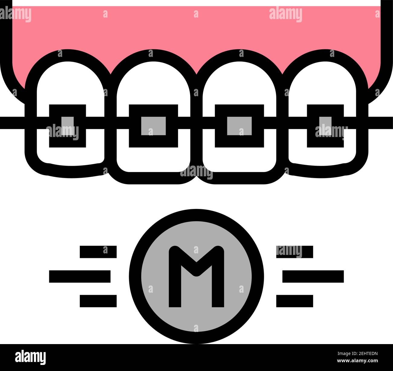 metal material tooth braces color icon vector illustration Stock Vector ...