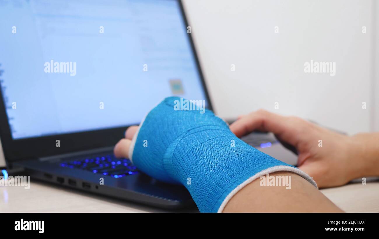 Fiberglass cast hand uses laptop program code Stock Photo