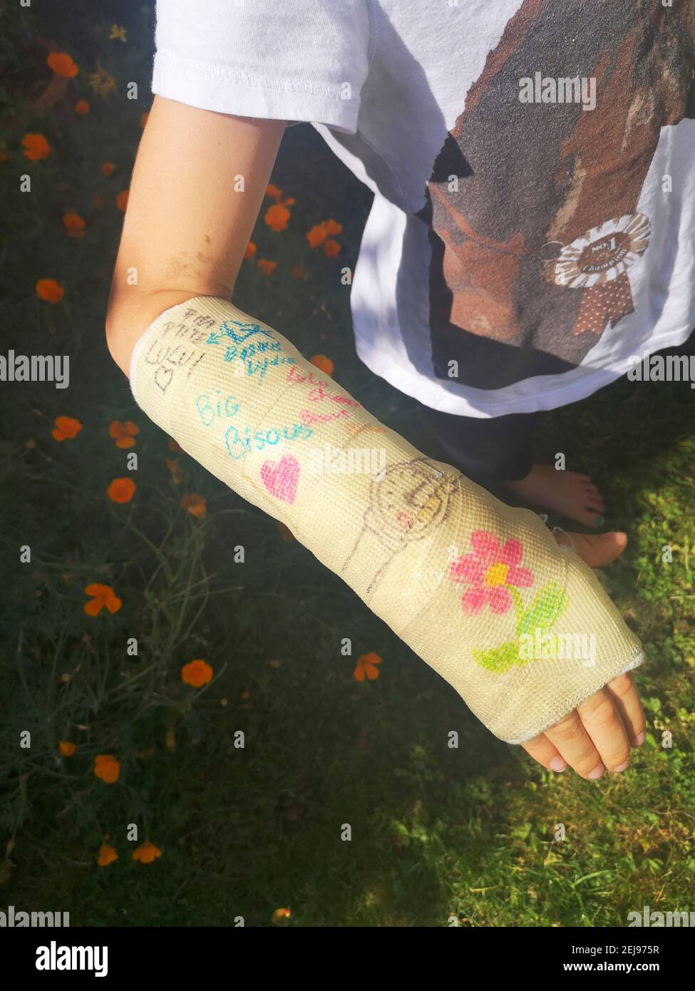 Signed Arm Cast