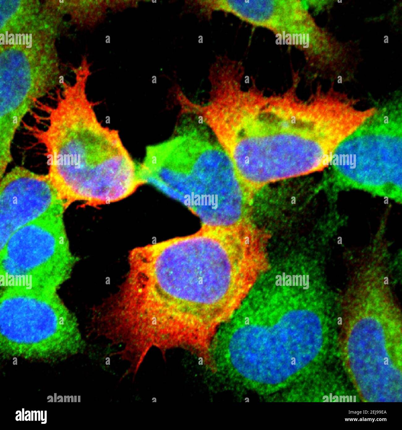 Cells infected with langat virus Stock Photo