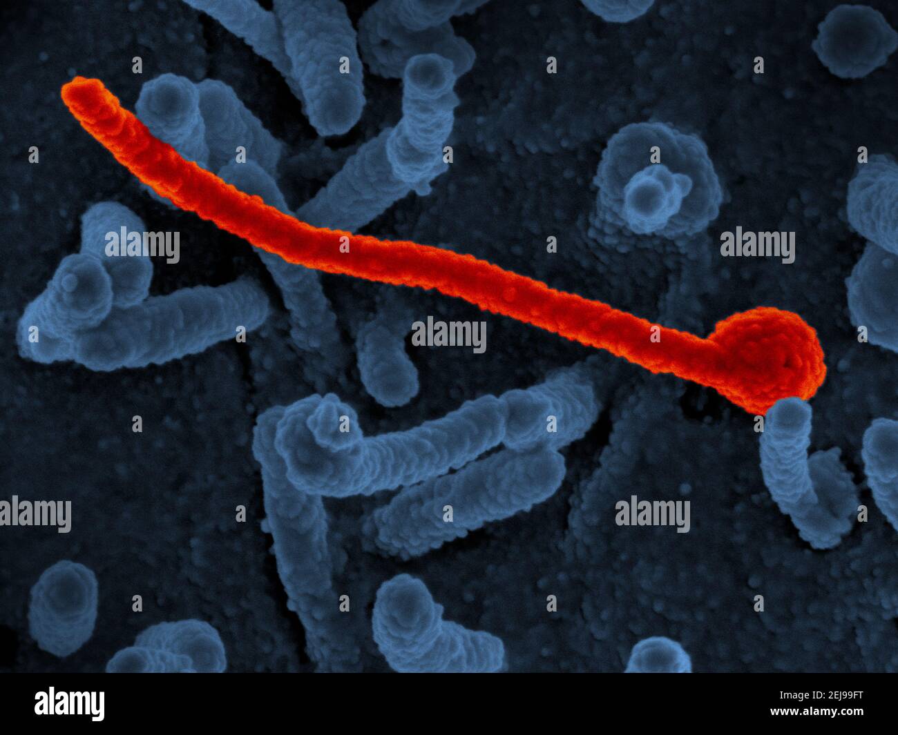 Ebola virus makona from west african epidemic Stock Photo