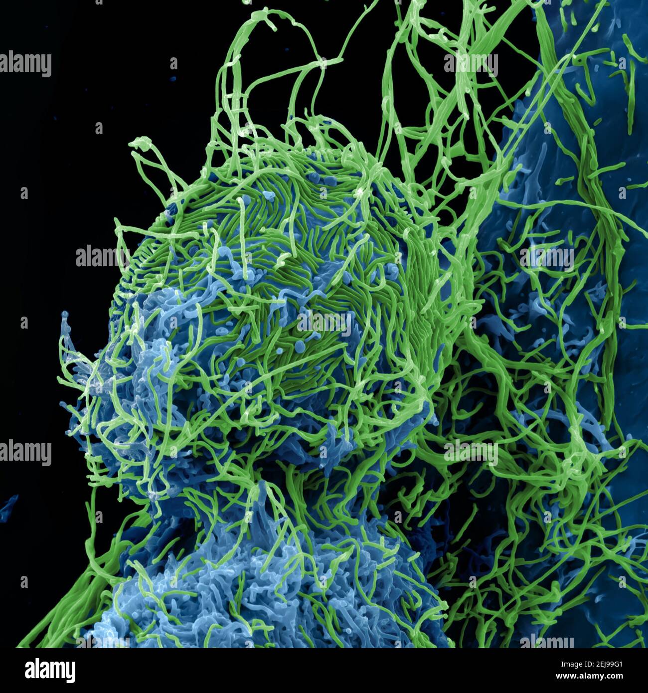 Ebola virus particles Stock Photo