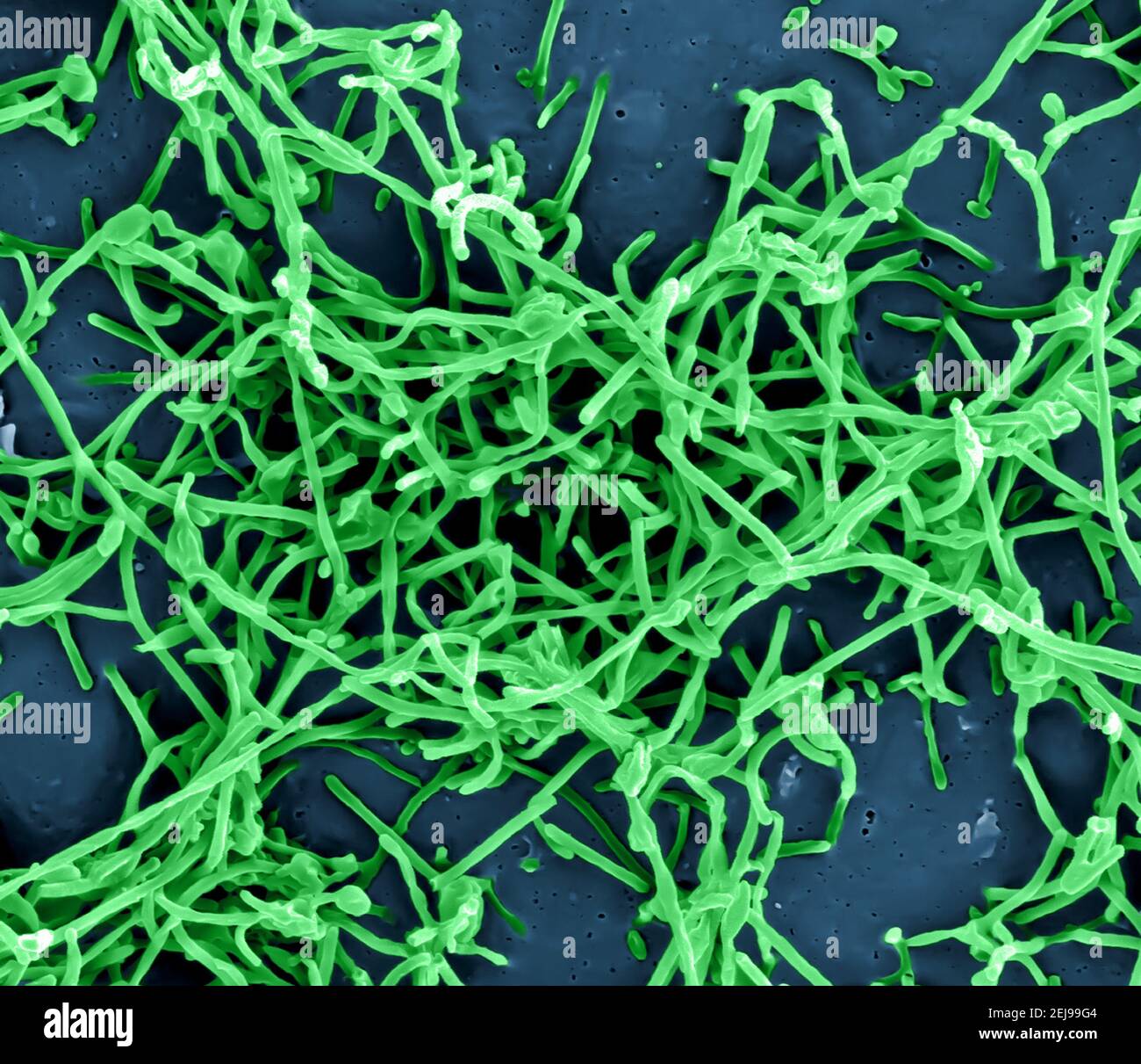 Ebola virus particles Stock Photo