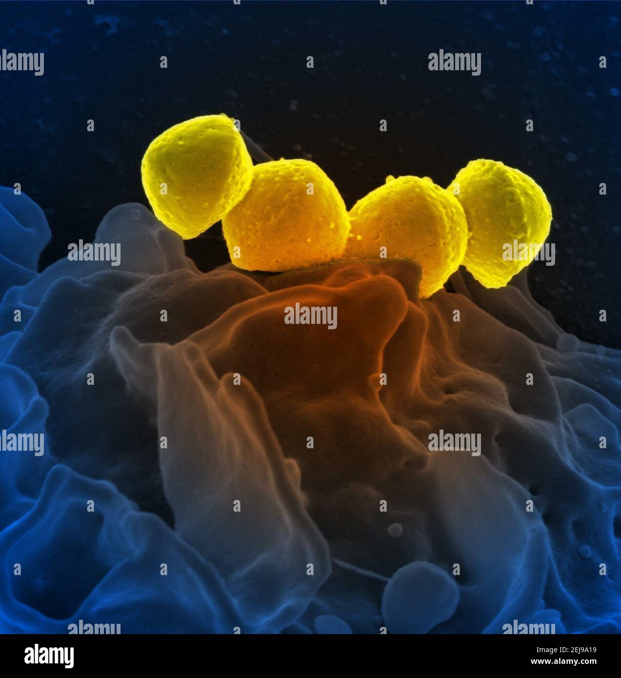 Group a streptococcus bacteria on human neutrophil Stock Photo