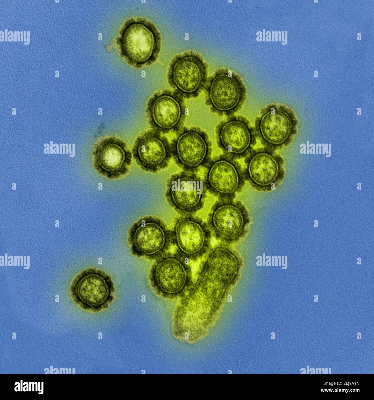 H1n1 influenza virus particles Stock Photo