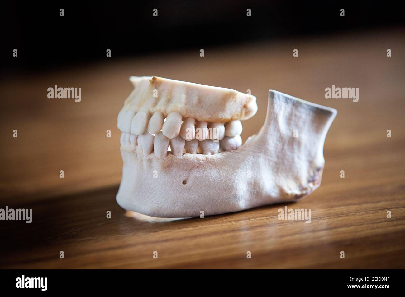 3D Printing Made From Images Of A Patient Stock Photo Alamy 3d-printing-made-from-images-of-a-patient-stock-photo-alamy