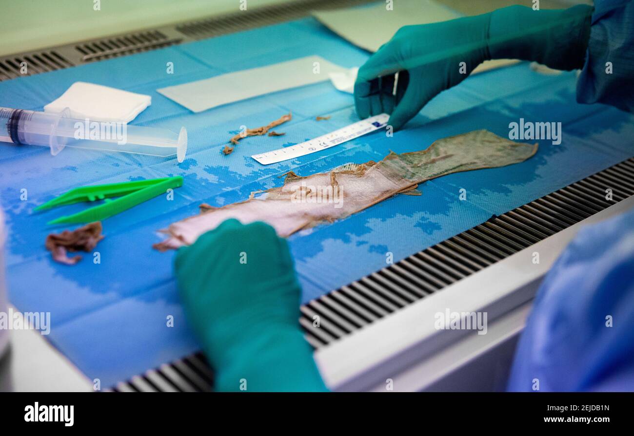 Preparation of skin samples for skin grafting Stock Photo - Alamy
