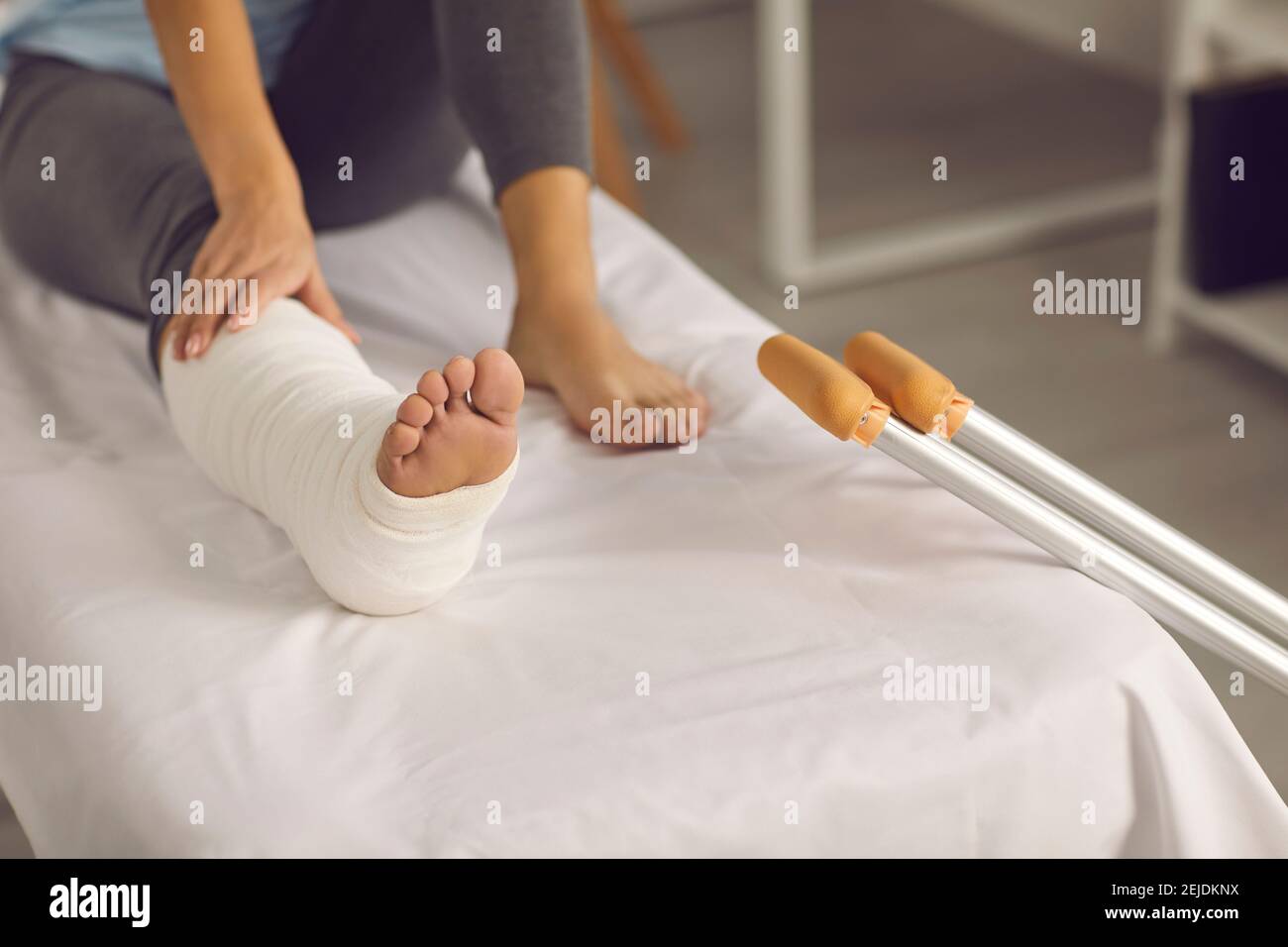 Woman with a broken plastered leg sitting on a couch after first aid