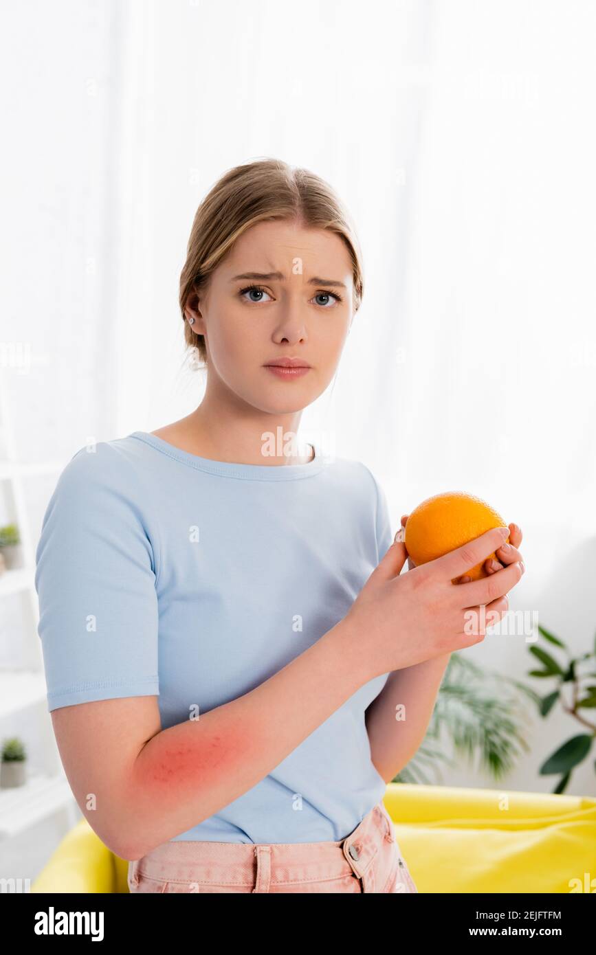 Worried woman with allergy holding orange Stock Photo Alamy