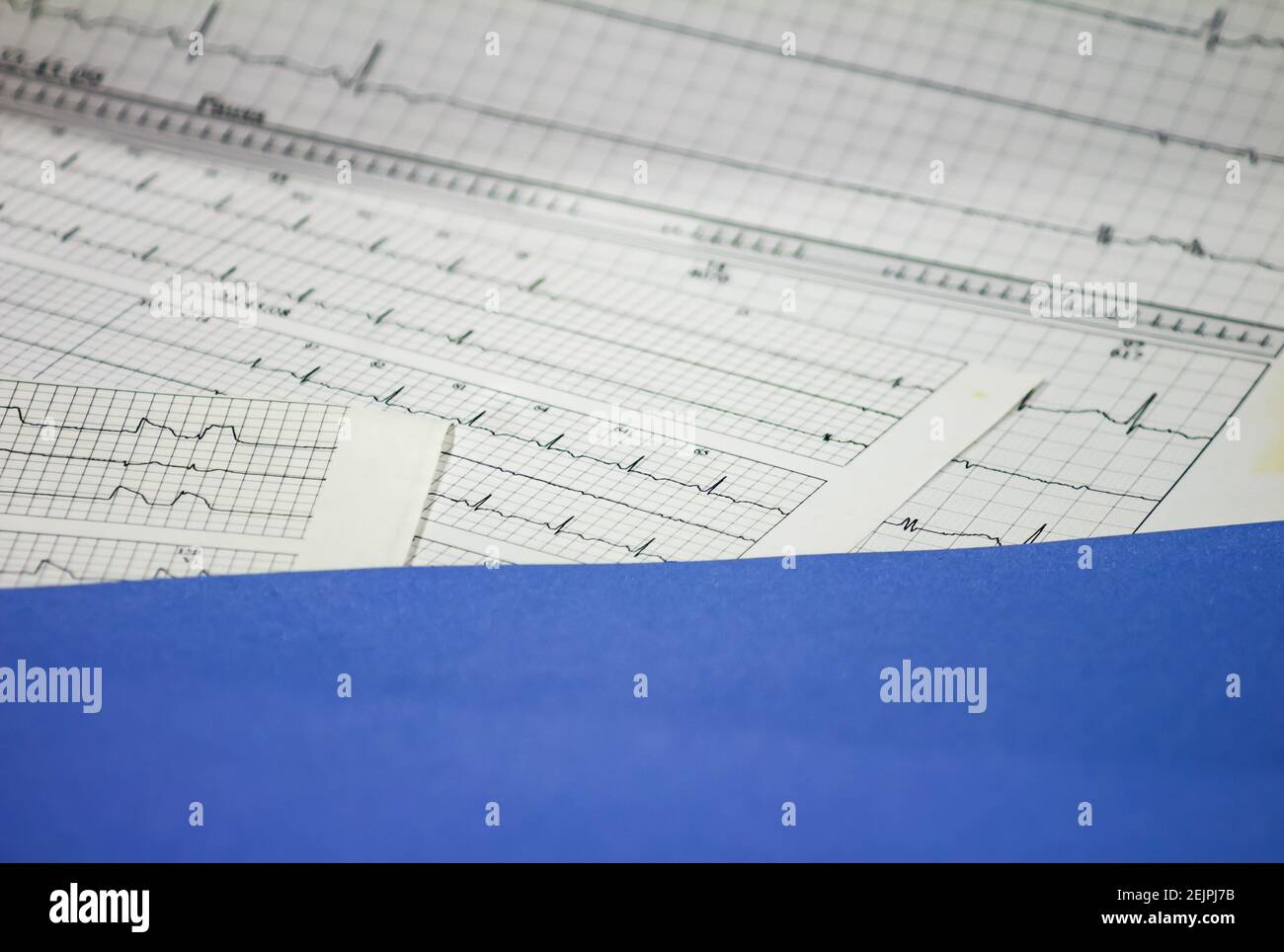 Tracing of electrocardiograms on graph paper. Records of heart activity. Heartbeat with arrhythmia. Selective focus with a portion out of focus. Stock Photo