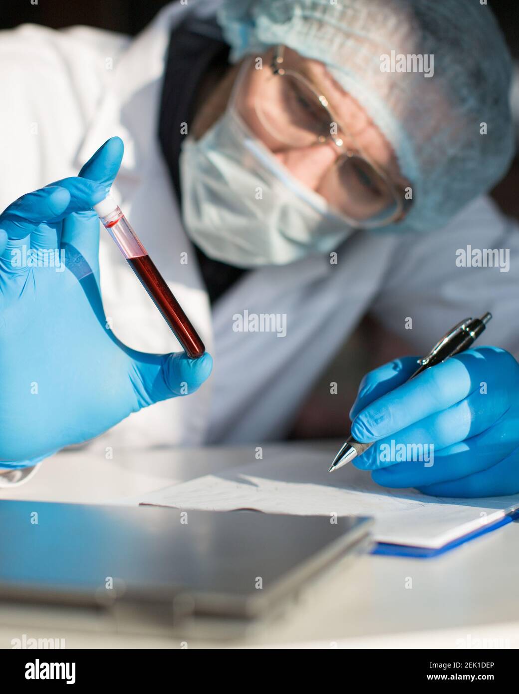 A test tube with infected blood in the hands of a doctor in the ...