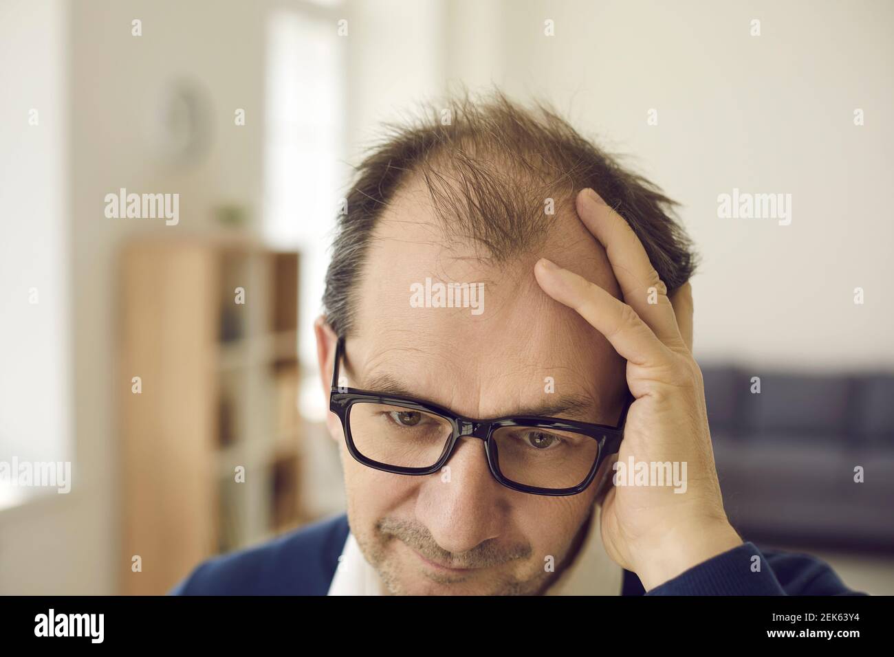 Balding middle aged man concerned about hair loss touches bald spots on his head Stock Photo