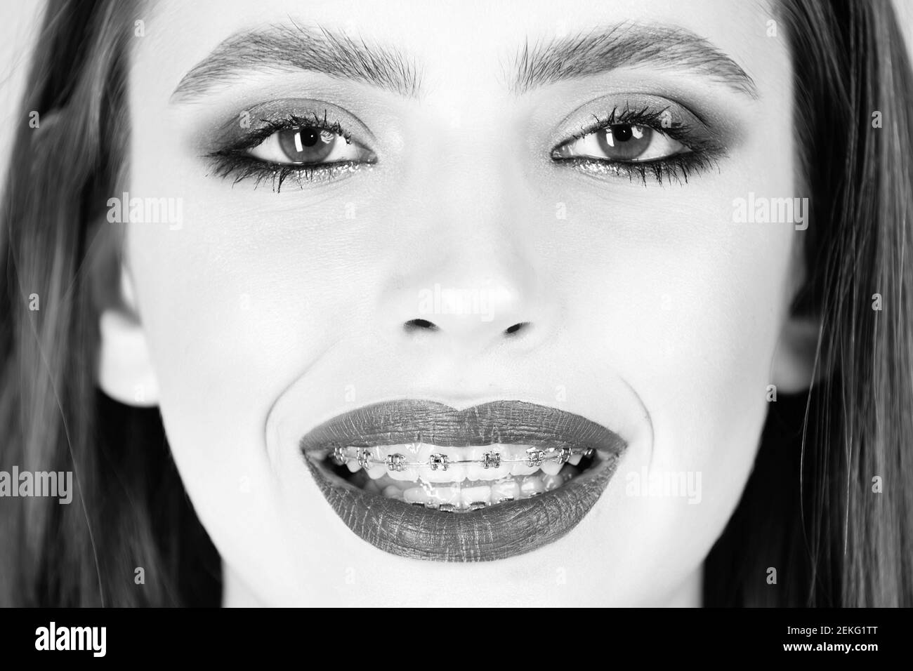 Teeth braces close up. Happy young woman with braces on teeth. Portrait