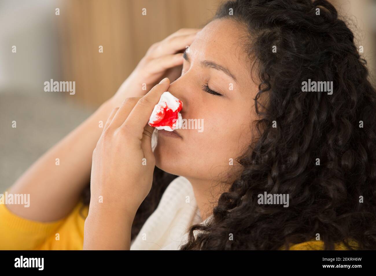 Nose bleed hires stock photography and images Alamy