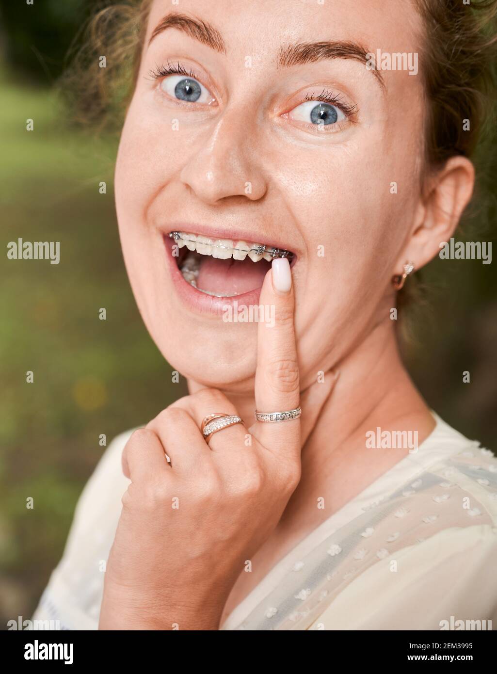 Close up of young woman pointing at orthodontic brackets on teeth. Charming female patient demonstrating results of dental braces treatment. Concept of dentistry and orthodontic treatment. Stock Photo