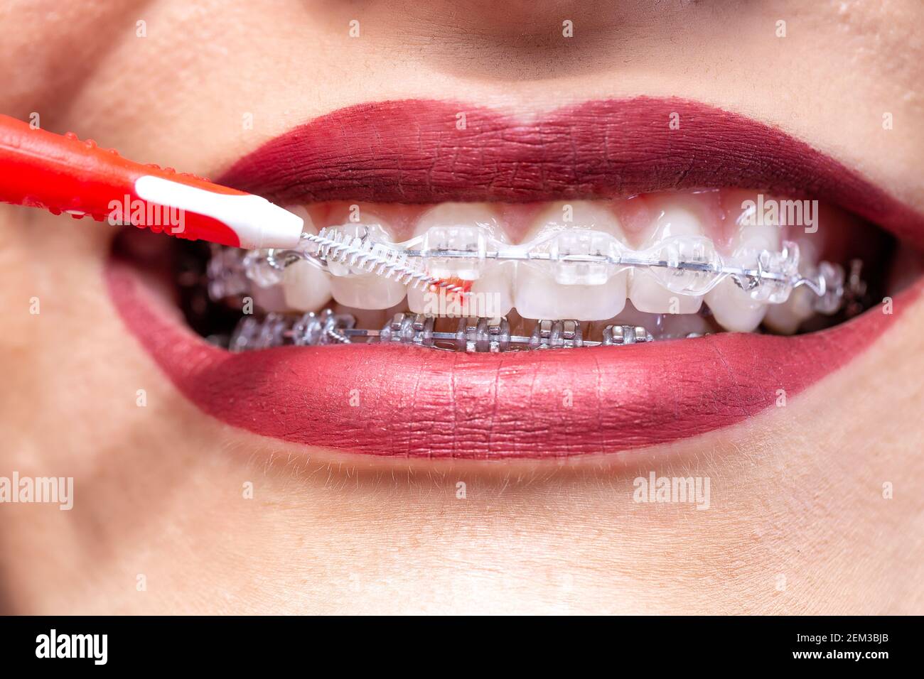 Proxabrush for in between teeth area hygiene, braces concept Stock Photo Alamy