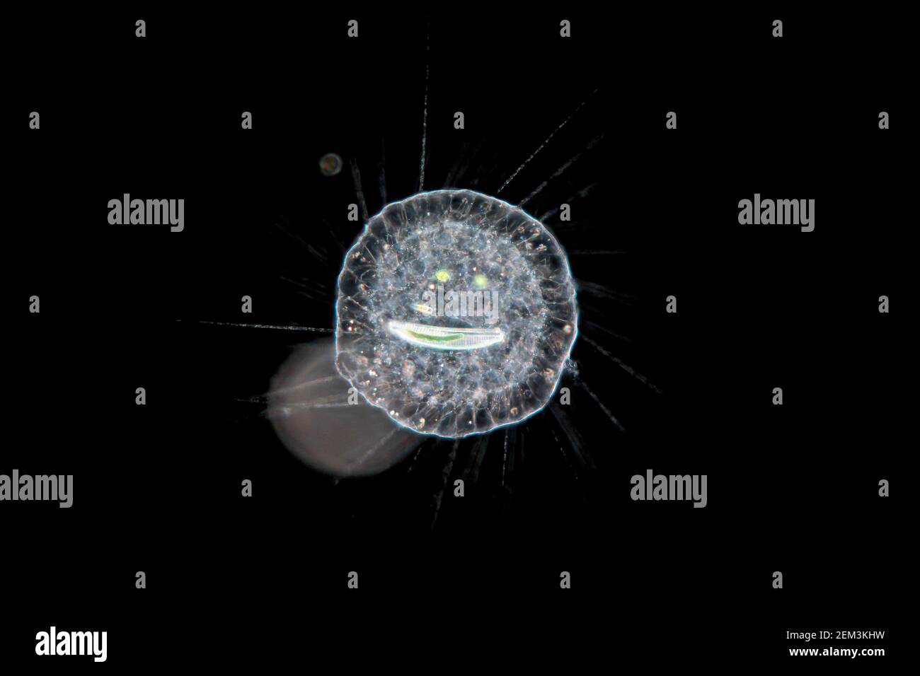 sun animalcules, heliozoans (Actinosphaerium), dark field microscope image, magnification: x120 related to 35mm Stock Photo