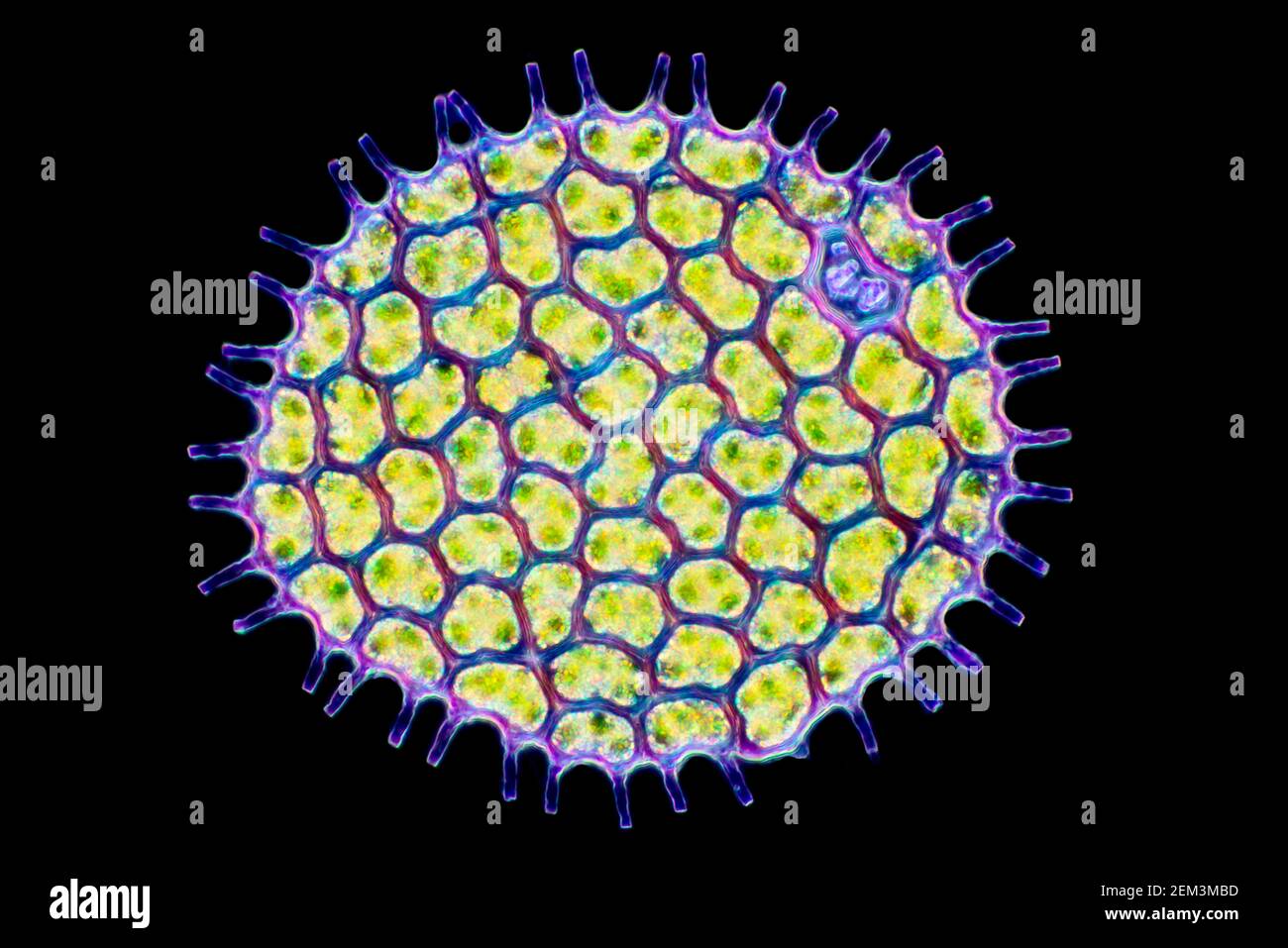 green alga (Pediastrum spec.), colony-building green algae, dark field microscopic image, magnification x120 related to 35 mm Stock Photo