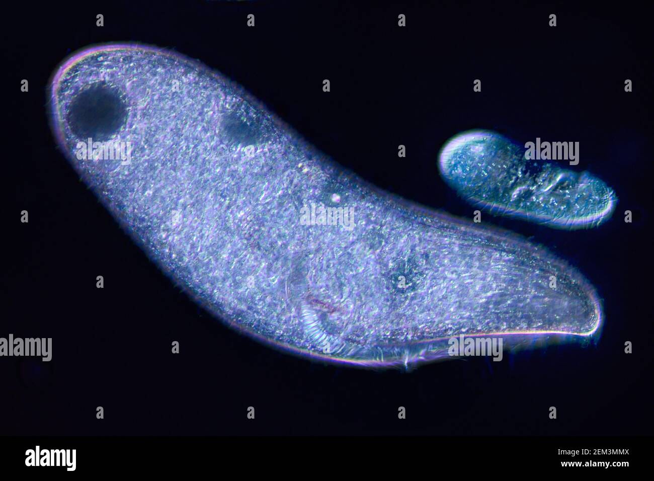 ciliates (Blepharisma americana), dark field microscopic image, magnification x32 related to 35 mm Stock Photo