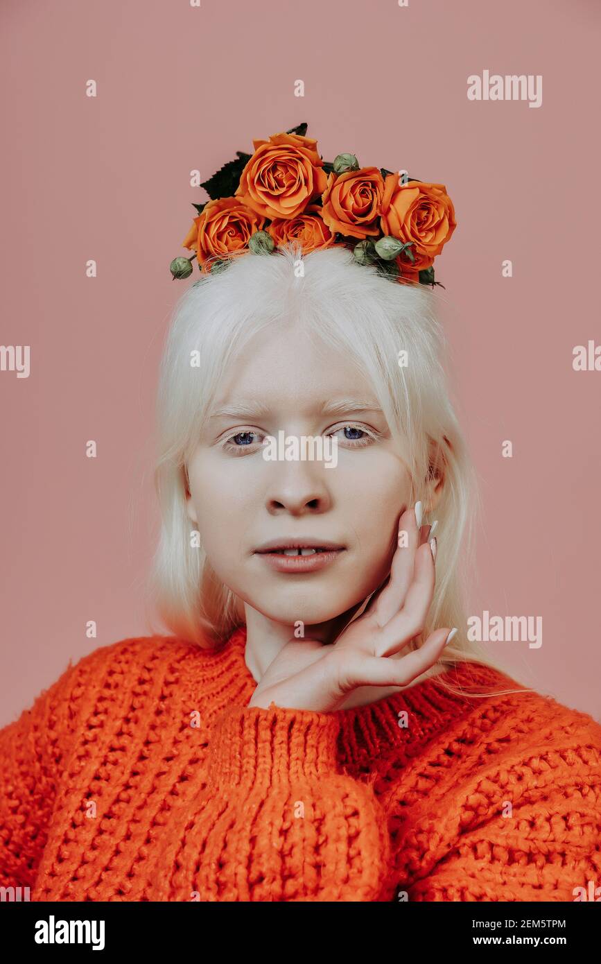 Albino girl hi-res stock photography and images - Alamy
