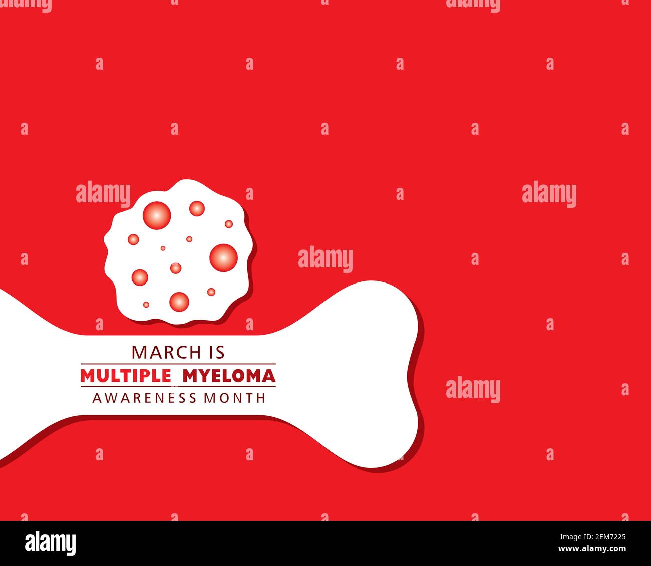 Vector illustration of Multiple Myeloma (Type of bone marrow cancer ...