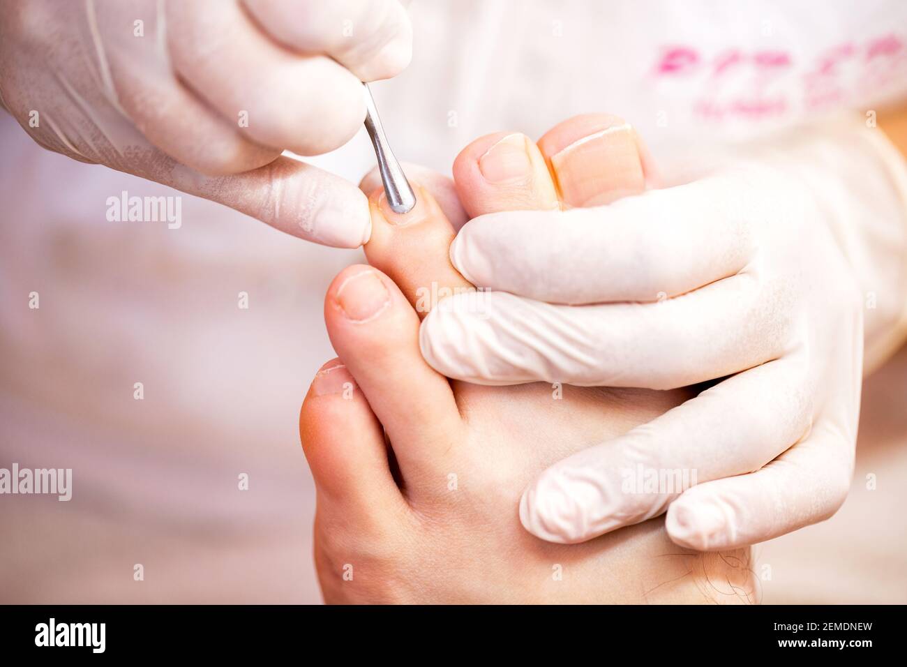 Cuticle treatment for pretty and clean toe nails, men’s pedicure toe