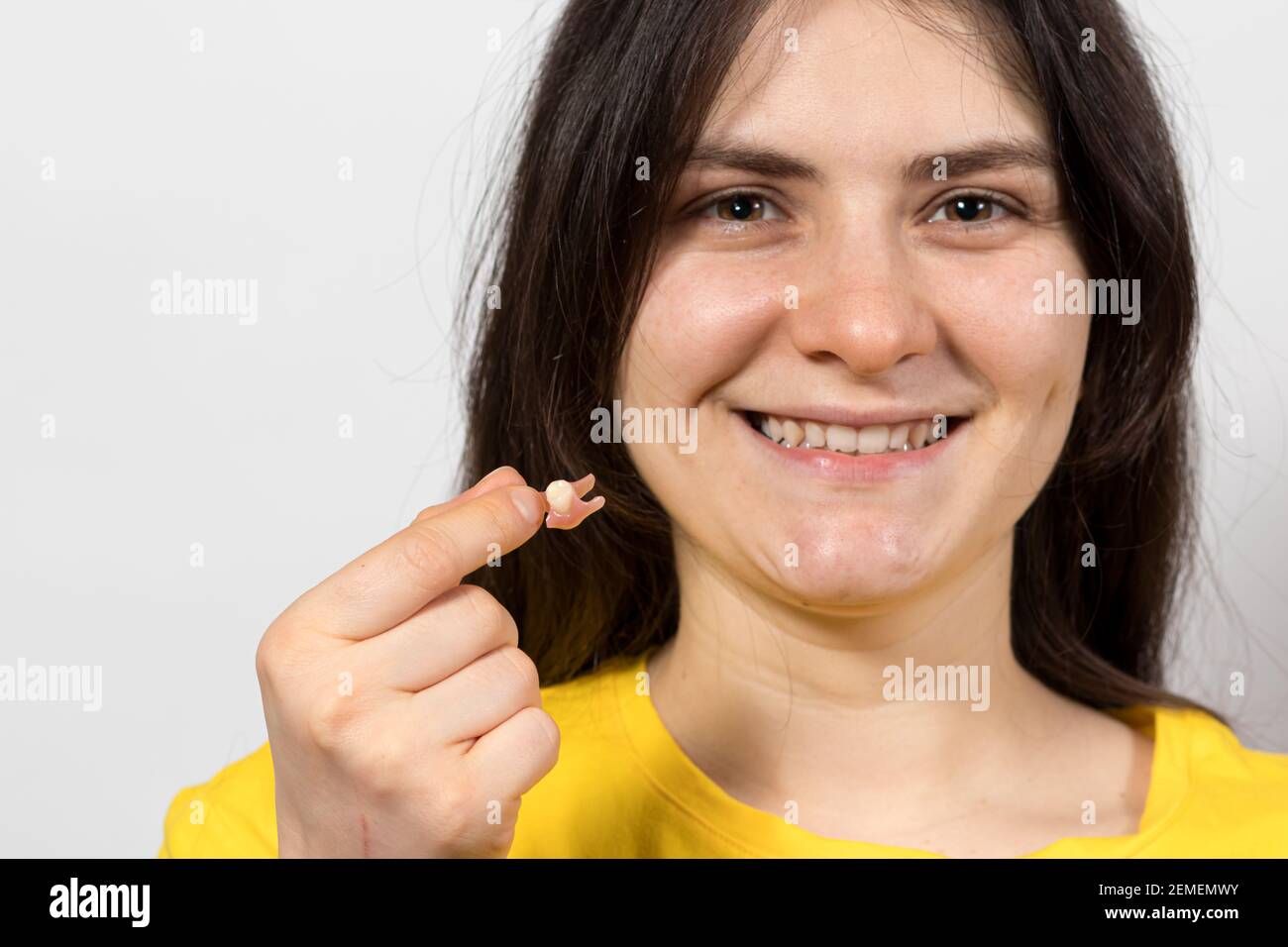 A female patient of a dental clinic holds in her hand a single potes - a removable tooth as an alternative to dental implantation. Stock Photo