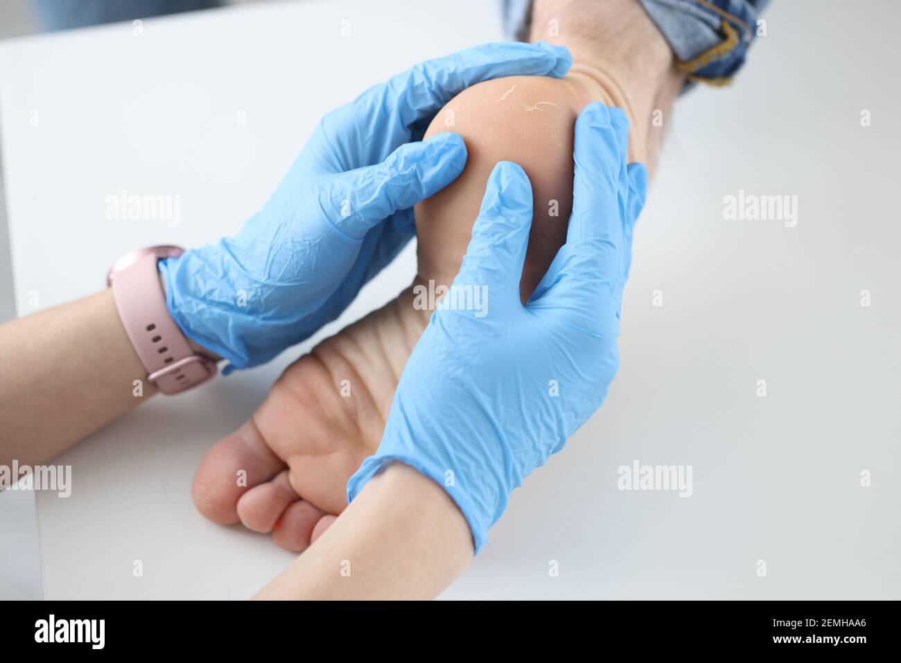 Doctor dermatologist in gloves examining patients heel closeup Stock Photo