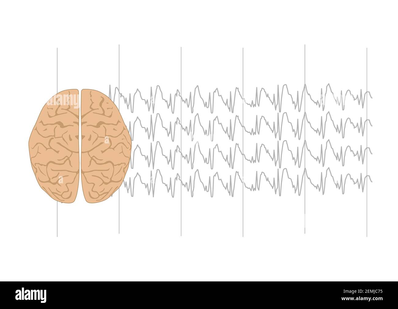 Vector illustration of human brain and abnormal generalized spkie and wave complexes  representing generalized seizure. Stock Vector