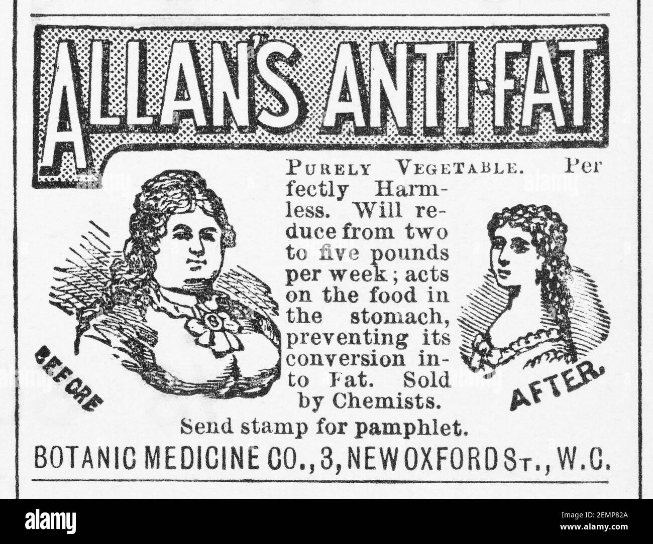 Old Victorian magazine newsprint Allan's Anti-Fat advert from 1897 - pre advertising standards. Metaphor Weight Watchers, obesity, fatphobia. Stock Photo