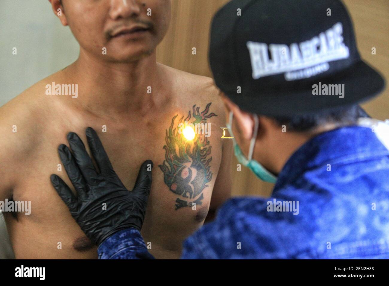 A clinic officer from the Da'wah and Social community illuminates tattoos  when the free tattoo removal program is in Bandung, West Java, on May 25,  2019. Removing free tattoos is a program