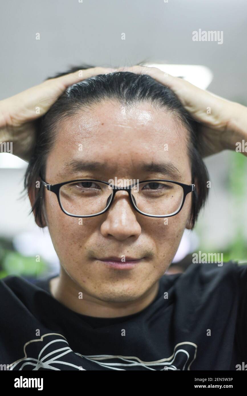 A Chinese programmer shows his hairline at an Internet company in Hangzhou city, east China's Zhejiang province, 10 June 2019. An Internet company in the city of Hangzhou has been praised online A Chinese programmer shows his hairline at an Internet company in Hangzhou city, east China's Zhejiang province, 10 June 2019. An Internet company in the city of Hangzhou has been praised online