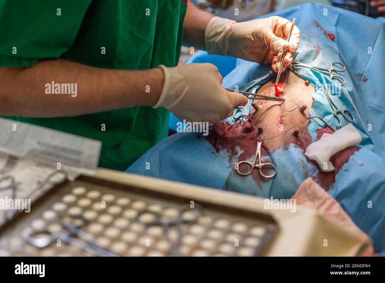 wumen castrations 