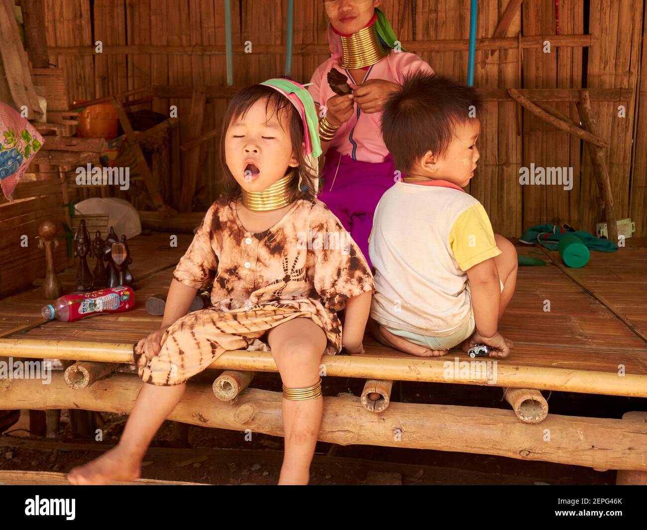 A Karen or Long Neck tribal girl with her unique necklace is yawning sleepily Stock Photo
