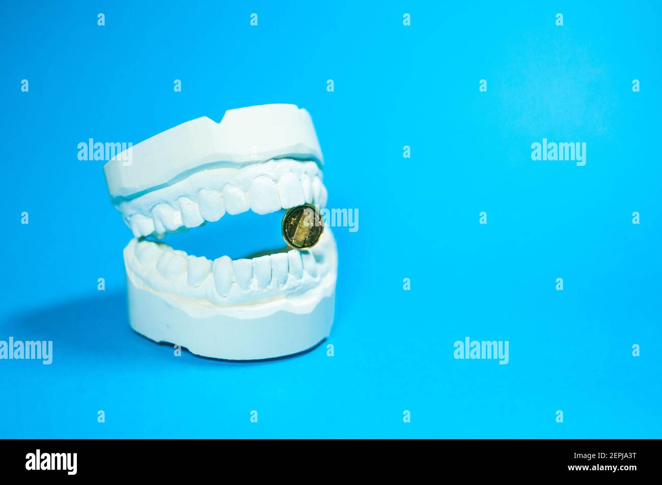 View of the impression of a bit, with the upper and lower jaw in front ...