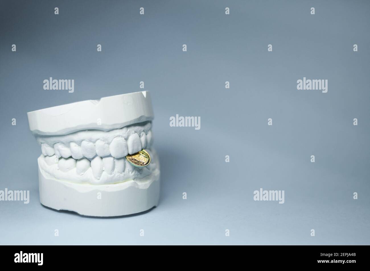 View of the impression of a bit, with the upper and lower jaw in front of a light background. There is still a small gold coin between the pines Stock Photo