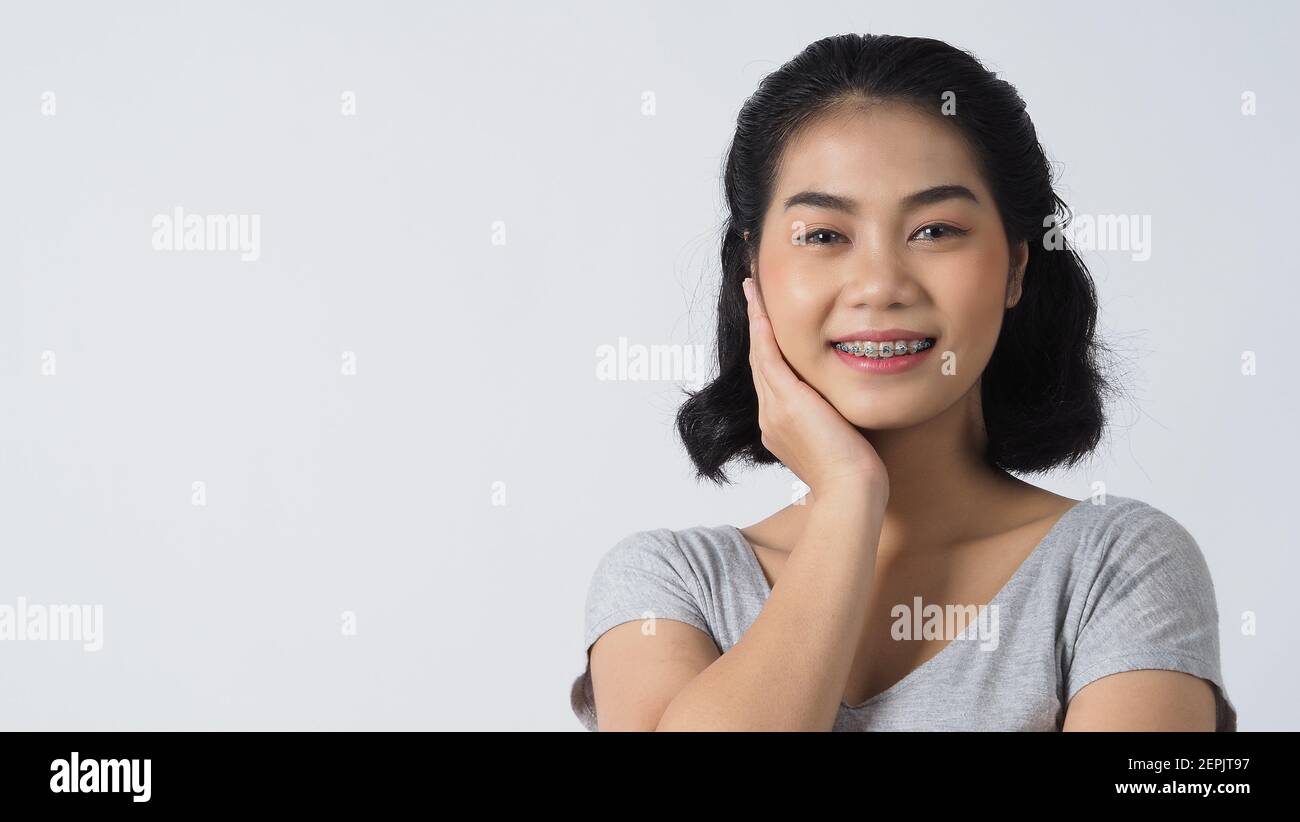 Dental brace teen girl smiling looking on a camera. white teeth with blue braces. Dental care