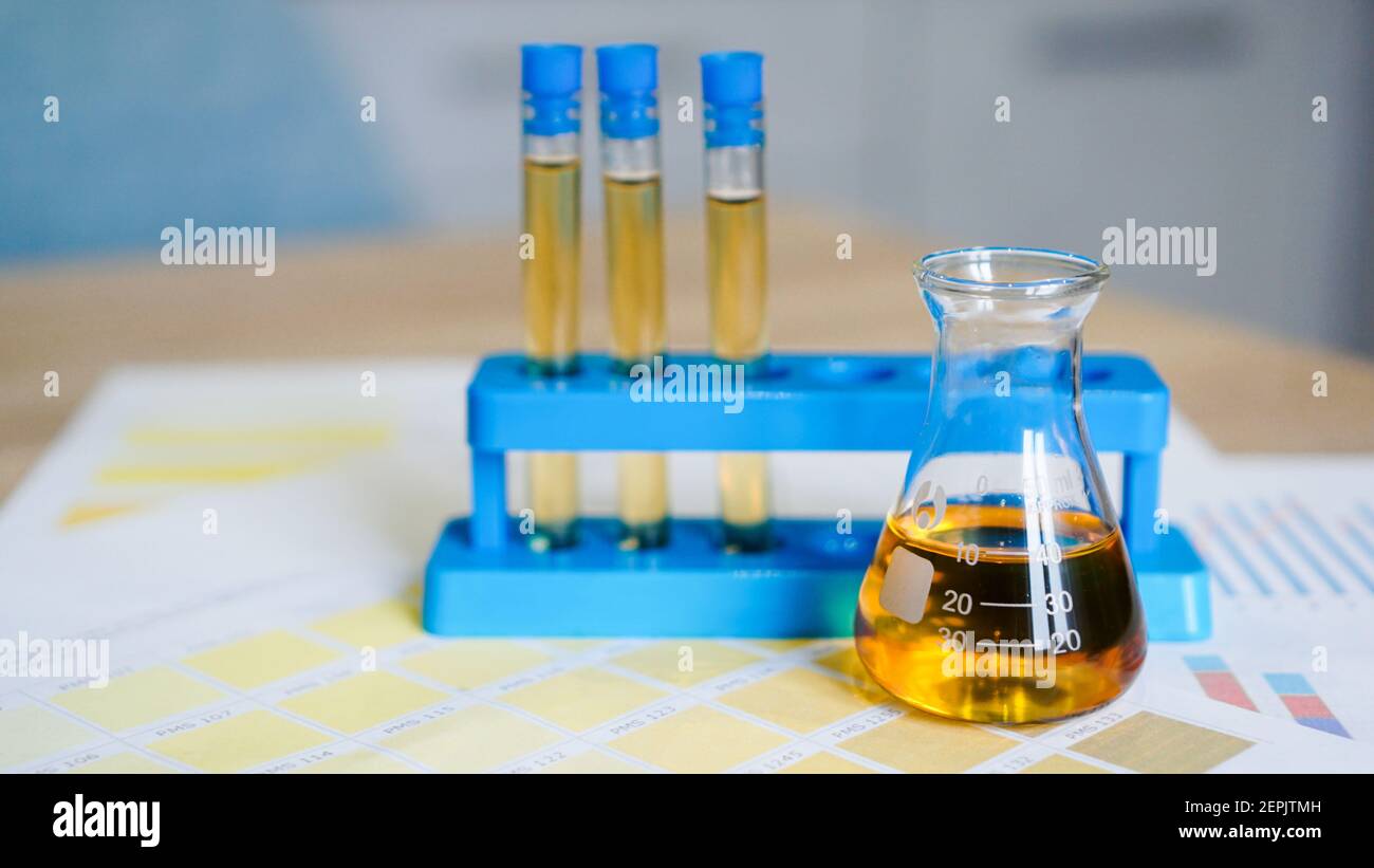Flask and test tubes at the stand with urine on medical color schemes