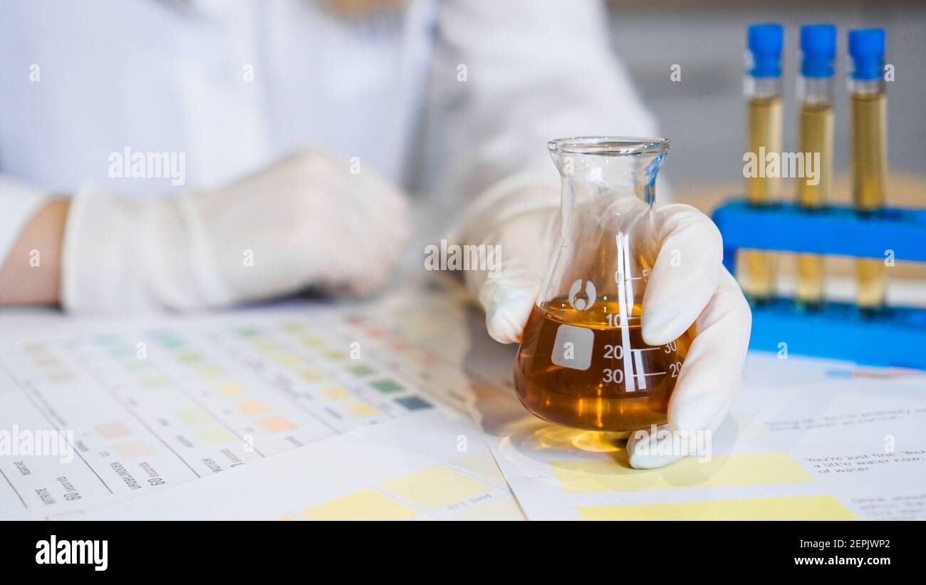 Woman making urine test with ph material in laboratory. Female hands in