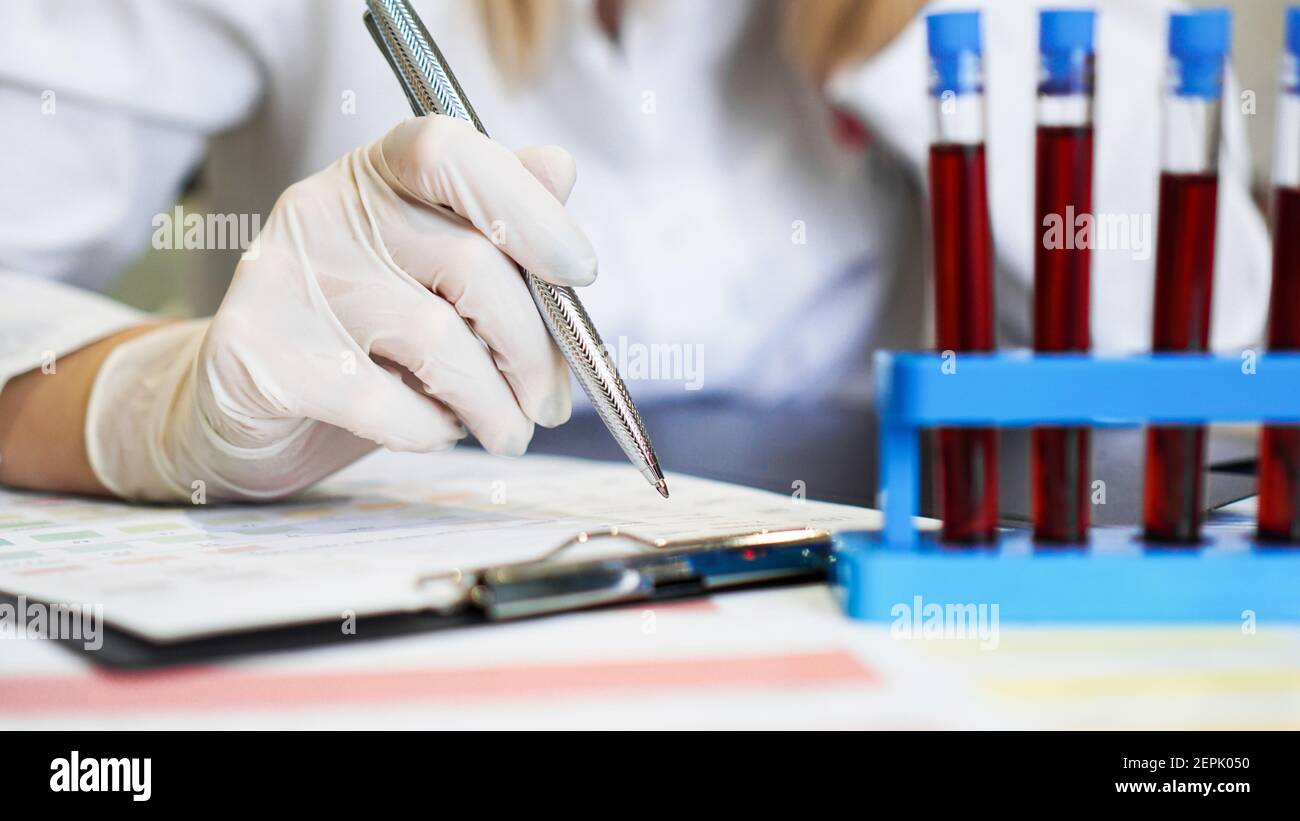Woman working with blood samples in laboratory, closeup. The doctor ...