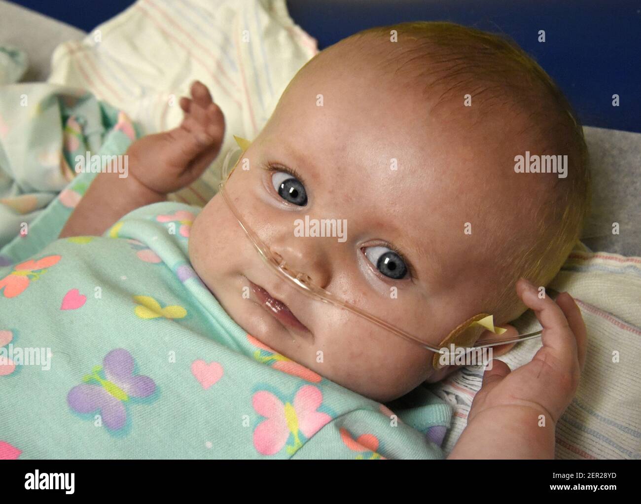Parents LeeAnn Janes and Wayne Brown of Hagerstown bring their 4 month old daughter Autumn Brown to University of Maryland Medical Center for pre surgery examination the day before the baby girl under...