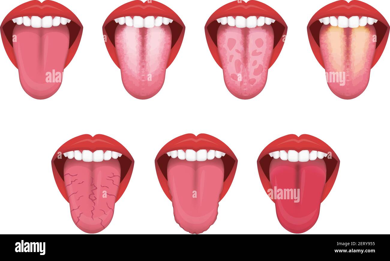 Tongue’s health sign vector illustration set Stock Vector Image & Art ...