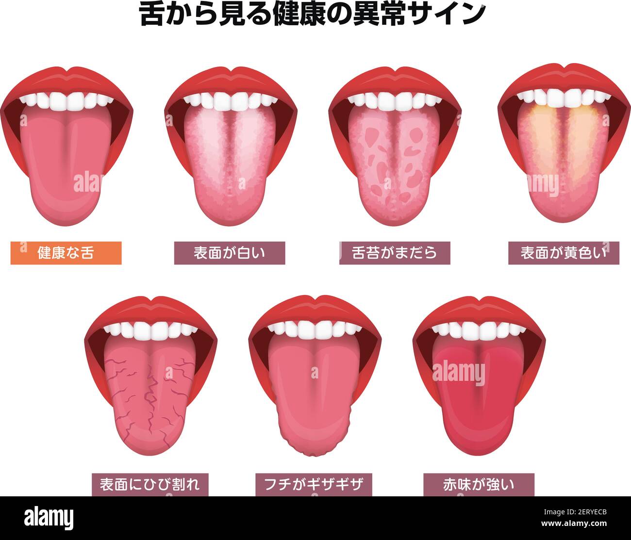 Tongue S Health Sign Vector Illustration Set Stock Vector Image Art Alamy