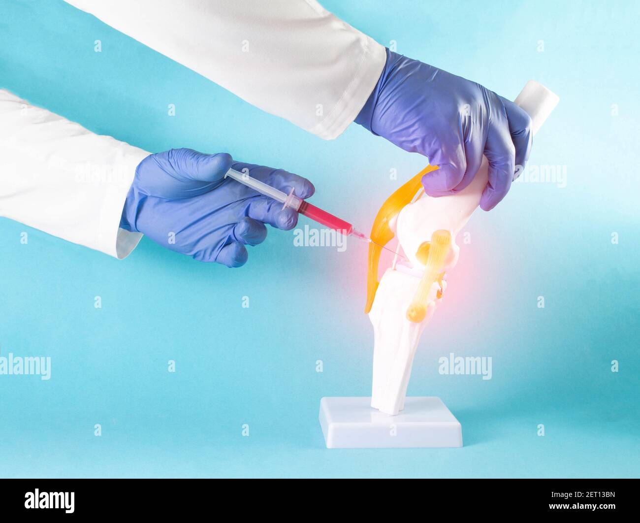 The doctor injects the patient's blood plasma into the knee joint to