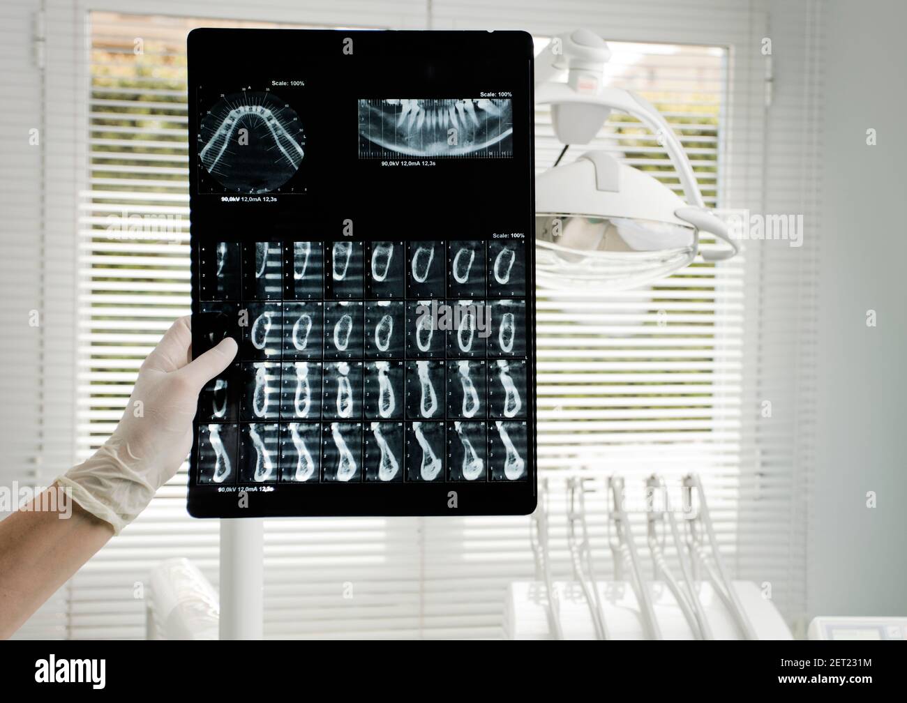 dental doctor, oral x-ray exams (oral radiography), dental clinic background Stock Photo