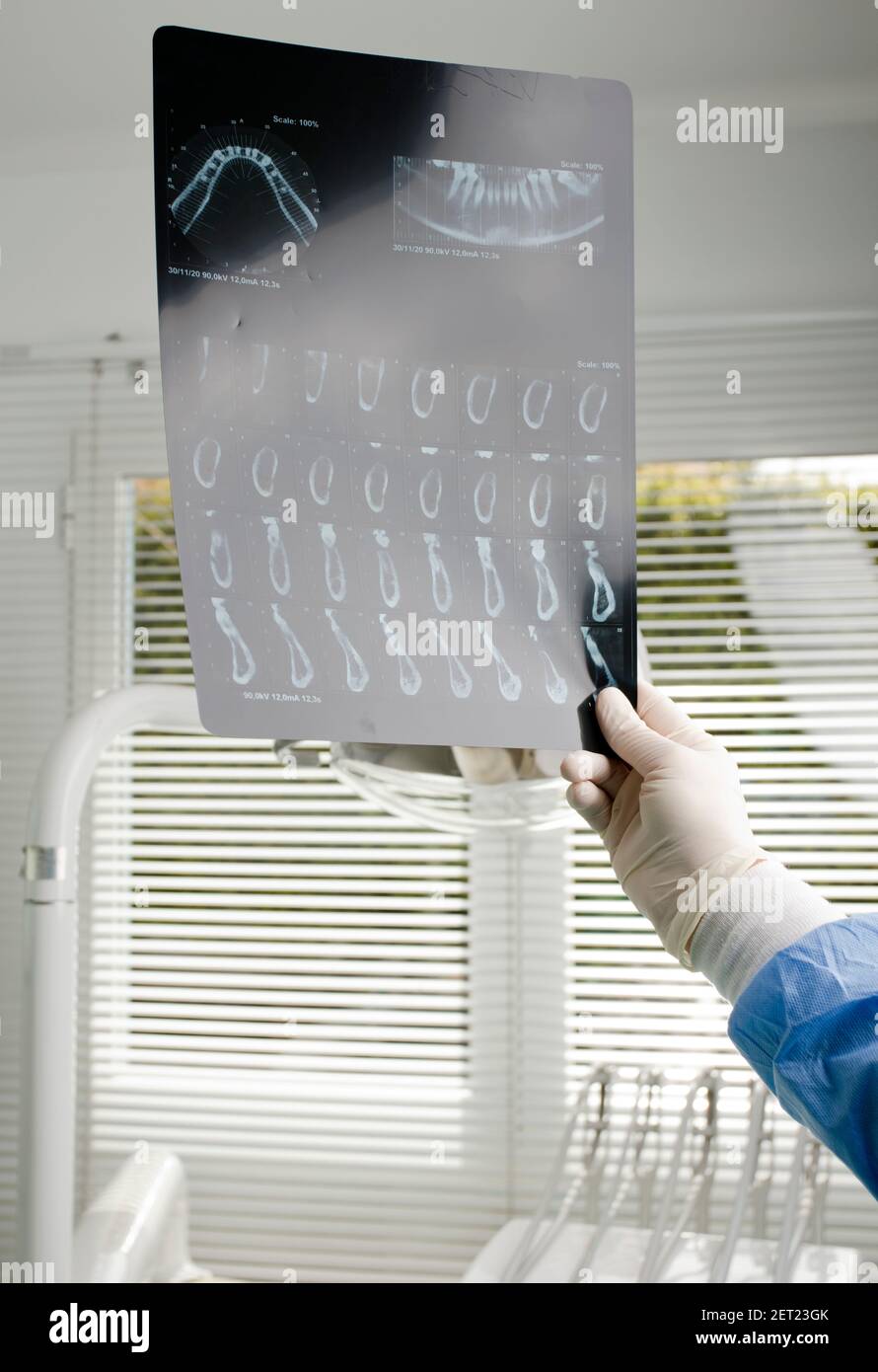 dental doctor, oral x-ray exams (oral radiography), dental clinic background Stock Photo
