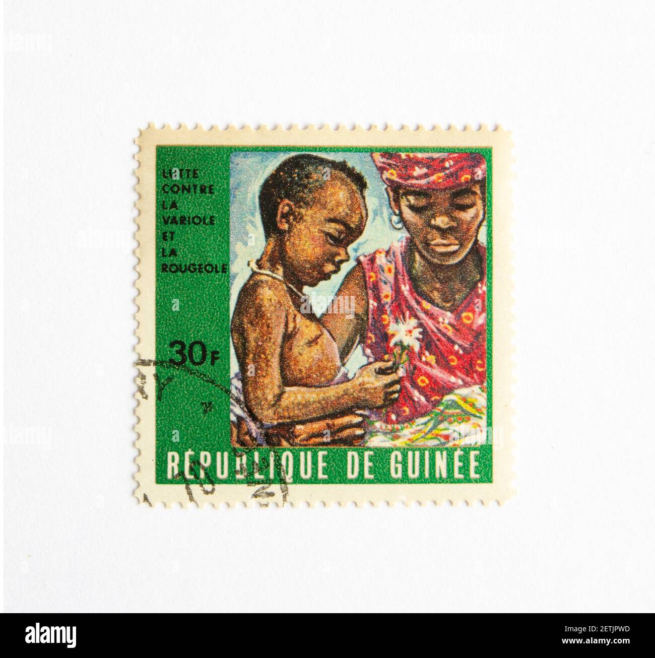 01.03.2021 Istanbul Turkey. Guinea Republic Postage Stamp. circa 1972. The fight for measles and smallpox control. vaccination baby Stock Photo