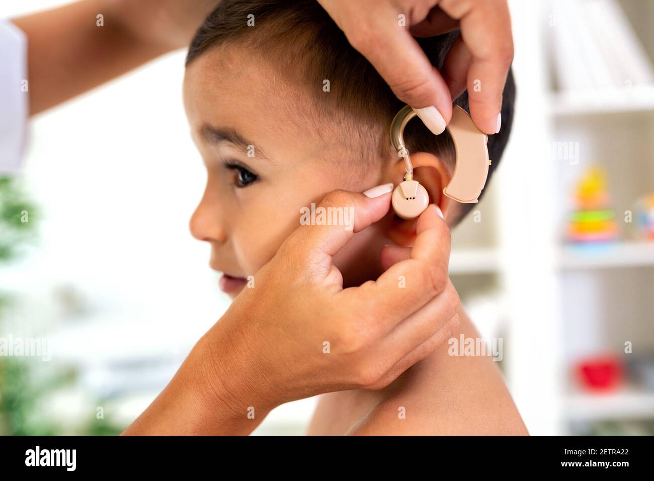 Placement of the hearing aid medical device on child’s ear done by his